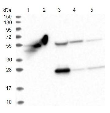 All lanes : Anti-OTUD1 antibody (ab122481) at 1/250 dilutionLane 1 : RT-4 cell lysateLane 2 : U-251 MG cell lysateLane 3 : Human plasma lysateLane 4 : Human liver tissue lysateLane 5 : Human tonsil tissue lysatedeveloped using the ECL technique