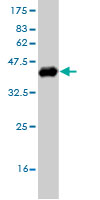 Western blot against tagged recombinant protein immunogen using ab58238 Otx1 antibody at 1ug/ml.