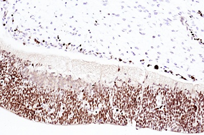 IHC-P image of Otx2 staining on Rat E12 embryo using ab114138 (1:1500). The sections were deparffinized and subjected to heat mediated antigen retrieval using citric acid. The section were then blocked using 1% BSA for 10 mins at 21°C. ab114138 was diluted 1:1500 using TBS/BSA/Azide and incubated for 2 hours at 21°C. The secondary antibody used was goat polyclonal to rabbit IgG conjugated to Biotin (1:250).