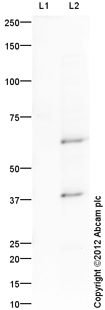 All lanes : Anti-Otx2 antibody (ab114138) at 1 µg/mlLane 1 : OTX1 (Human) - Recombinant ProteinLane 2 : OTX2 Transient Overexpression LysateLysates/proteins at 0.1 µg per lane.SecondaryGoat Anti-Rabbit IgG H&L (HRP) (ab97051) at 1/10000 dilutiondeveloped using the ECL techniquePerformed under reducing conditions.