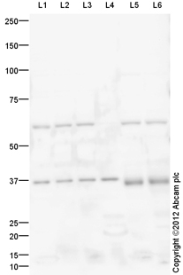 All lanes : Anti-Otx2 antibody (ab114138) at 1 µg/mlLane 1 : E10 Mouse Embryo Brain Tissue LysateLane 2 : E14 Mouse Embryo Brain Tissue LysateLane 3 : E16 Ms Embryo Brain Tissue LysateLane 4 : Eye (Mouse) Whole Cell Lysate - normal tissue (ab4029)Lane 5 : Y79 (Human retinoblastoma cell line) Whole Cell LysateLane 6 : WERI (Human Retinoblastoma) Whole Cell LysateLysates/proteins at 10 µg per lane.SecondaryGoat Anti-Rabbit IgG H&L (HRP) (ab97051) at 1/10000 dilutiondeveloped using the ECL techniquePerformed under reducing conditions.