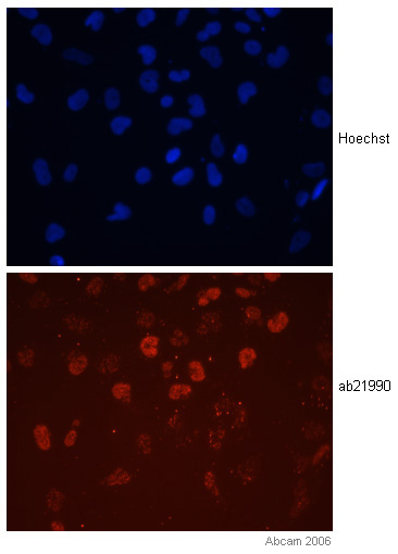 The image shows staining of Otx2 in human embryonic stem cells differentiated into neuroectoderm. As would be expected, staining is nuclear.