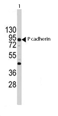 Anti-P cadherin antibody (ab65599) at 1/60 dilution + K562 cell line lysates at 35 µg