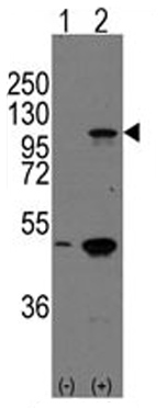 All lanes : Anti-P cadherin antibody (ab65599) at 1/60 dilutionLane 1 : 293 cell line lysate nontransfected Lane 2 : 293 cell line lysate transiently transfected with the P cadherin geneLysates/proteins at 2 µg/ml per lane.