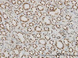 P15RS antibody (ab55022) used in immunohistochemistry at 3ug/ml on formalin fixed and paraffin embedded human kidney.