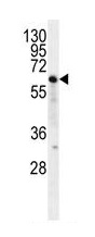 Anti-NKD2 antibody - C-terminal (ab170804) at 1/100 dilution + Jurkat cell line lysates at 35 µg