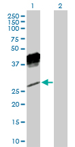 All lanes : Anti-NKG2A antibody (ab169285) at 1 µg/mlLane 1 : NKG2A transfected 293T cell lysateLane 2 : Non-transfected 293T cell lysateLysates/proteins at 15 µl per lane.SecondaryGoat Anti-Rabbit IgG (H+L)-HRP at 1/7500 dilutiondeveloped using the ECL technique