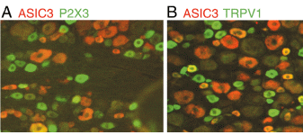 Image A: ab10248, at a dilution of 1/1000, staining P2X3 (green) in rat dorsal root ganglia sections by Immunohistochemistry (PFA perfusion fixed frozen sections). Other structures visualized with anti-ASIC3 (red). Image B: Structures in rat dorsal root ganglia sections visualized with anti-ASIC3 (red) and anti-TRPV1 (green). Double-labeled cells are yellow or orange.