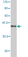 Anti-P2X5b antibody (ab55675) at 5 µg/ml + partial 0.2 µg/lane of recombinant protein with a tagSecondaryGoat anti mouse IgG (H&L)-HRP conjugate at 1/5000 dilution