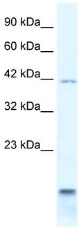 Anti-P2X6 antibody (ab32827) at 0.5 µg/ml + HepG2 cell lysateSecondaryHRP conjugated anti Rabbit IgG at 1/50000 dilution