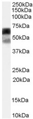 Anti-P4HA1 antibody (ab59497) at 0.2 µg/ml + HEK293 cell lysate (35µg protein in RIPA buffer)