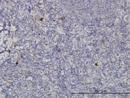 NKIRAS2 antibody (ab57303) used in immunohistochemistry at 3ug/ml on formalin fixed and paraffin embedded human tonsil.