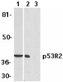 All lanes : Anti-p53R2 antibody (ab8105) at 1 µg/mlLane 1 : A431 cell lysateLane 2 : 3T3 cell lysate with absence of blocking peptideLane 3 : 3T3 cell lysate with presence of blocking peptide