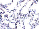 ab8105 at 1µg/ml staining p53R2 in lung tissue by IHC