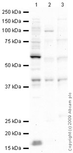 All lanes : Anti-p53R2 antibody (ab63814) at 1 µg/mlLane 1 : MCF7 (Human breast adenocarcinoma cell line) Whole Cell LysateLane 2 : Skeletal Muscle (Human) Tissue Lysate - adult normal tissue (ab29330)Lane 3 : Placenta (Human) Tissue Lysate - adult normal tissue (ab29745)Lysates/proteins at 10 µg per lane.SecondaryGoat polyclonal to Rabbit IgG - H&L - Pre-Adsorbed (HRP) at 1/3000 dilutionPerformed under reducing conditions.