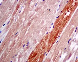 Immunohistochemical analysis of paraffin-embedded Human muscle tissue labeling p53R2 with ab154194 at 1/50 dilution.