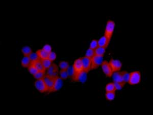 Immunofluorescent staining of MCF7 cells labeling p53R2 with ab154194 at 1/250 dilution