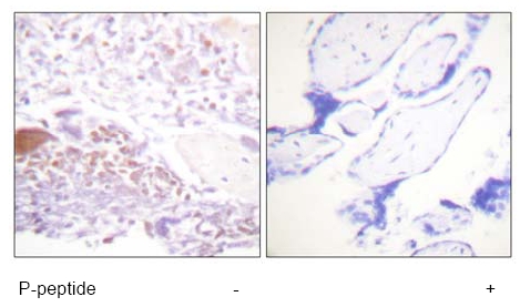 Immunohistochemistry analysis of paraffin-embedded human placenta tissue using ab61064 at 1/50-1/100 dilution with or without addition of Phospho-peptide.