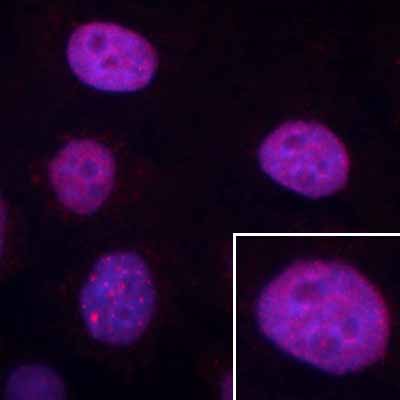 ab8133 staining cultured human HeLa cells by ICC/IF.  Cells were PFA fixed and permeabilized in 0.5% Triton X100 prior to blocking in 5% BSA for 1 hour at 20°C.  The primary antibody was diluted 1/800 and incubated with the sample for 1 hour at 20°C.  A Cy3® conjugated donkey anti-mouse antibody diluted 1/400 was used as the secondary.See Abreview