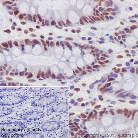 Immunohistochemical analysis of paraffin-embedded Human colon tissue labeling p66 alpha with ab188472 at 1/1000 dilution, followed by Goat Anti-Rabbit IgG H&L (HRP) (ab97051) at 1/500 dilution. Nucleus staining on Human colon is observed. Counter stained with Hematoxylin.Secondary antibody only control: Used PBS instead of primary antibody, secondary antibody is Goat Anti-Rabbit IgG H&L (HRP) (ab97051) at 1/500 dilution.