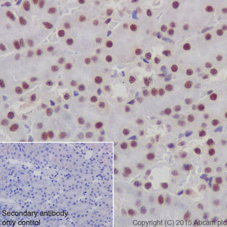 Immunohistochemical analysis of paraffin-embedded Mouse kidney tissue labeling p66 alpha with ab188472 at 1/1000 dilution, followed by Goat Anti-Rabbit IgG H&L (HRP) (ab97051) at 1/500 dilution. Nucleus staining on mouse kidney is observed. Counter stained with Hematoxylin.Secondary antibody only control: Used PBS instead of primary antibody, secondary antibody is Goat Anti-Rabbit IgG H&L (HRP) (ab97051) at 1/500 dilution.