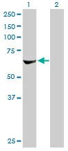 All lanes : Anti-P70 S6 Kinase beta antibody (ab76960) at 1/1000 dilutionLane 1 : RPS6KB2 transfected 293T lysateLane 2 : Non-transfected 293T lysateLysates/proteins at 25 per lane.