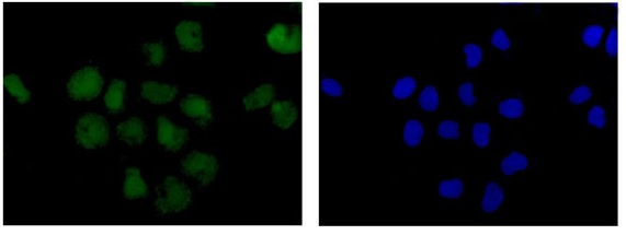 Immunofluorescent staining of 4% paraformaldehyde fixed HeLa cells labeling P70 S6 Kinase beta using ab184551 at a 1/250 dilution and a Goat anti rabbit IgG (Alexa Fluor® 488) secondary at a 1/200 dilution (green) costained with Dapi (blue).