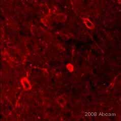 ab11382 staining normal mouse brain tissue sections by IHC-FoFr.  Sections were PFA fixed and blocked with 0.5% TNB for 30 minutes at 25°C.  The primary antibody was diluted 1/100 and incubated with the sample for 18 hours at 4°C.  An Alexa Fluor® 555 conjugated goat anti-rabbit antibody, diluted 1/500, was used as the secondary.  This image (taken at 80x) demonstrates p75 positive neurons in the basal forebrain.See Abreview