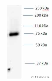Anti-p75 NGF Receptor antibody (ab8874) at 1/500 dilution + whole cell lysate prepared from human WiDr colorectal cancer cell line at 5 µgSecondaryHRP conjugated donkey anti-rabbit polyclonal at 1/5000 dilutiondeveloped using the ECL techniqueExposure time :  12 minutesImage courtesy of an anonymous Abreview.See Abreview