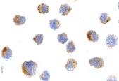 ab25958 at 10µg/ml staining p75NGF Receptor in A20 cells by ICC/IF