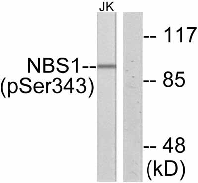 All lanes : Anti-p95 NBS1 (phospho S343) antibody (ab47272) at 1/500 dilutionLane 1 : 5-30ug Jurkat cell extract, treated with immunogenic peptide.Lane 2 : 5-30ug Jurkat cell extract, untreated.SecondaryAlkaline Phosphatase Goat Anti IgG (H+L)