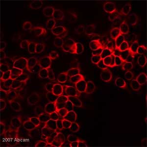 ab21060 at 1/50 staining human HeLa cells by ICC/IF. HeLa cells fixed for 10 minutes with 1.9 % formaldehyde in 2 % sucrose in PBS then permeabilised for 10 minutes with 0.5% NP40 in PBS-10% sucrose. The cells were then blocked in horse serum and  incubated with the antibody for 1 hour. An Alexa Fluor ® 555 conjugated donkey anti-rabbit antibody was used as the secondary.See Abreview