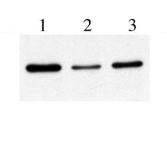 All lanes : Anti-PABP antibody [10E10] (ab6125) at 1/2000 dilutionLane 1 : 10ug of protein from MCF10A cells transfected with negative control siRNA.Lane 2 : 10ug of protein from MCF10A cells transfected with PABP specific siRNA.Lane 3 : 10 ug of protein from MCF10A cells transfected with PABP specific siRNA.SecondaryGoat anti-mouse 1/10000