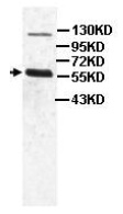 Anti-PACAP receptor antibody (ab104154) at 1/1000 dilution + Human fetal heart lysate