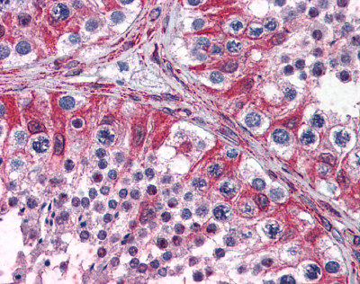 ab110144, at 3.75 µg/ml, staining PACE4 in formalin fixed, paraffin embedded Human testis by Immunohistochemistry.