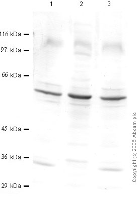 All lanes : Anti-PACE4 antibody - Aminoterminal end (ab39877) at 1/1000 dilutionLane 1 : SF treated PK15 CMLane 2 : TPA treated PK15 CMLane 3 : IL1-beta treated PK15 CMLysates/proteins at 30 µl per lane.