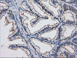 ab123913 at 1/150 dilution staining PACSIN3 in Paraffin-embedded Human prostate tissue by Immunohistochemistry.
