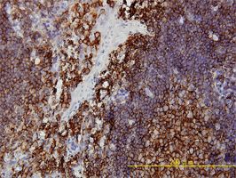PACT (PKR activating protein) / PRKRA antibody (ab56444) used in immunohistochemistry at 5ug/ml on formalin fixed and paraffin embedded human tonsil tissue.