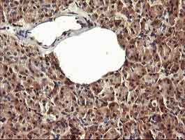 Immunohistochemical staining of paraffin-embedded Human pancreas tissue labelling PADI4 / PAD4 with ab140303 at 1/150 dilution.
