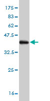 Western blot against tagged recombinant protein immunogen using ab57167 PADI4 / PAD4 antibody at 1ug/ml.