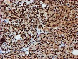 ab128086, at a dilution of 1/150, staining PADI4 / PAD4 in paraffin-embedded Human pancreas tissue by Immunohistochemistry.