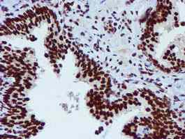ab128086, at a dilution of 1/150, staining PADI4 / PAD4 in paraffin-embedded Human prostate tissue by Immunohistochemistry.