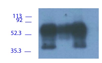 1. Frozen Raji cells lysate, immunoprecipitated with ab42062. Fresh Raji cells lysate, immunoprecipitated with ab42063. Frozen Raji cells lysate, immunoprecipitated with ab14989Reprobe with ab9527.The immunoprecipitation used covalently bound antibody to Sepharose beads as immunosorbent. This method of precipitation obviously differs from proteinA/G-sepharose or GoatxMs -Sepharose mediated immunoprecipitation protocols.