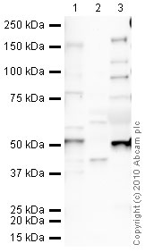 All lanes : Anti-PAI1 antibody (ab66705) at 1 µg/mlLane 1 : Liver (Human) Tissue Lysate - adult normal tissue (ab29889)Lane 2 : Lung (Human) Tissue LysateLane 3 : Human Plasma Total Protein Lysate Lysates/proteins at 10 µg per lane.SecondaryGoat polyclonal to Rabbit IgG - H&L - Pre-Adsorbed (HRP) at 1/3000 dilutionPerformed under reducing conditions.