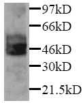 Anti-PAI1 antibody (ab7205) at 1/1000 dilution