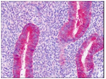 Immunohistochemical analysis of paraffin embedded, formalin fixed Human Uterus, Endometrium labeling PAICS using ab174685 at 10 µg/ml.