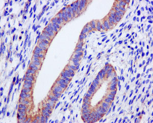 Immunohistochemical analysis of paraffin-embedded Human uterus tissue labeling PAIP1 with ab181359 at 1/50 dilution.