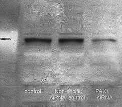 Western blot probing with PAK1 antibody (ab2477). The major band is at 65 kDa and weaker bands can be detected at 90 and 100 kDa. This picture was kindly submitted by Sue Thomas as part of her review.