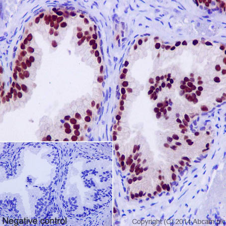 Immunohistochemical analysis of paraffin-embedded Human prostate hyperplasia tissue labeling Nkx3.1 with ab196020 at 1/500 dilution, followed by Goat Anti-Rabbit IgG H&L (HRP) (ab97051) secondary antibody at 1/500 dilution. Nuclear staining on Human prostate hyperplasia tissue is observed. Counter stained with Hematoxylin.Negative control: Used PBS instead of primary antibody, secondary antibody is Goat Anti-Rabbit IgG H&L (HRP) (ab97051) at 1/500 dilution.