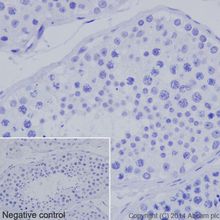 Immunohistochemical analysis of paraffin-embedded Human testis tissue labeling Nkx3.1 with ab196020 at 1/500 dilution, followed by Goat Anti-Rabbit IgG H&L (HRP) (ab97051) secondary antibody at 1/500 dilution. Human testis tissue acting as a negative control for Nkx3.1. Counter stained with Hematoxylin.Negative control: Used PBS instead of primary antibody, secondary antibody is Goat Anti-Rabbit IgG H&L (HRP) (ab97051) at 1/500 dilution.
